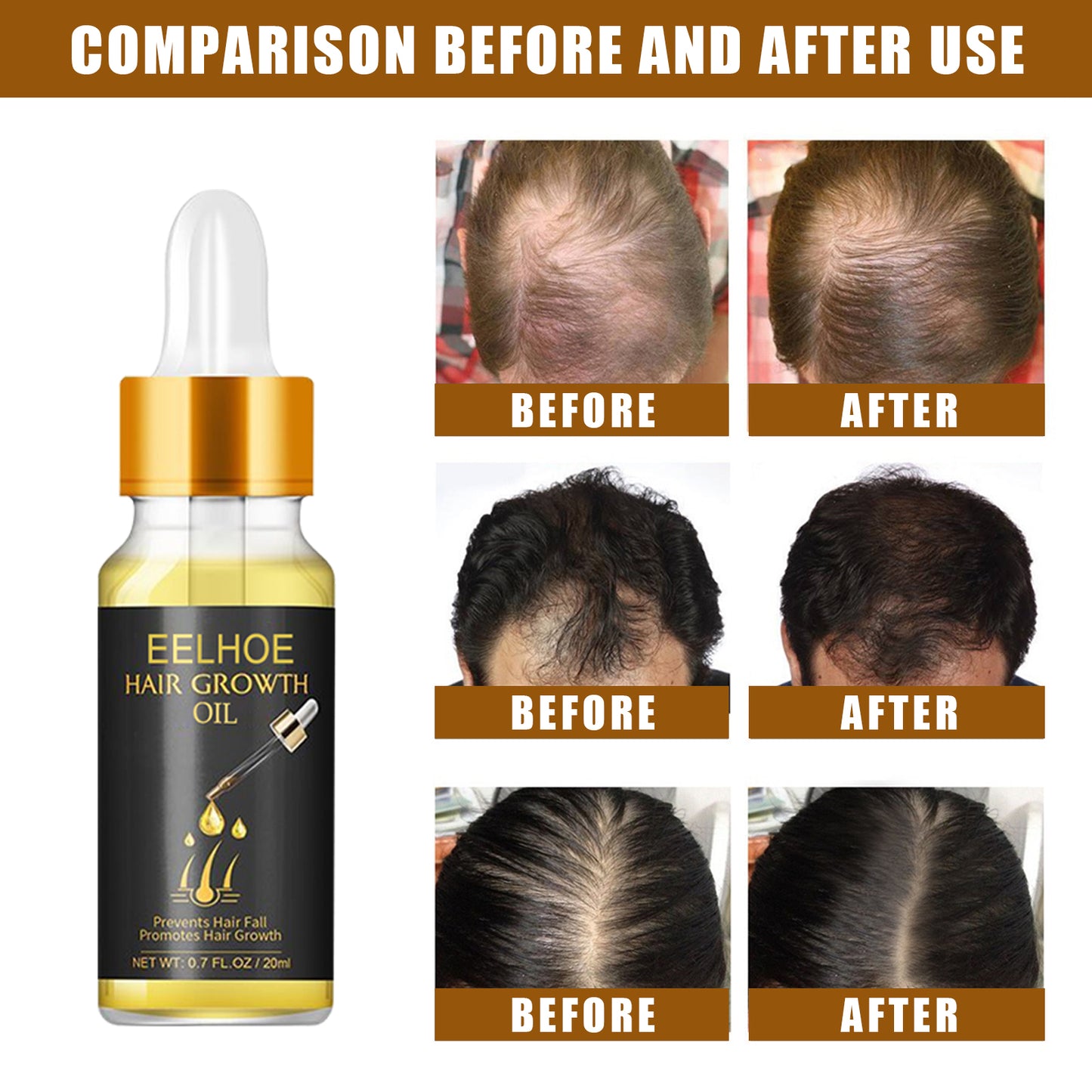 Hair Growth Oil, Strengthens And Strengthens Hair Essential Oil Softens And Moisturizes Hair And Thickens Hair Nutrient Solution