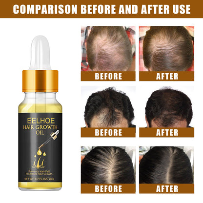 Hair Growth Oil, Strengthens And Strengthens Hair Essential Oil Softens And Moisturizes Hair And Thickens Hair Nutrient Solution