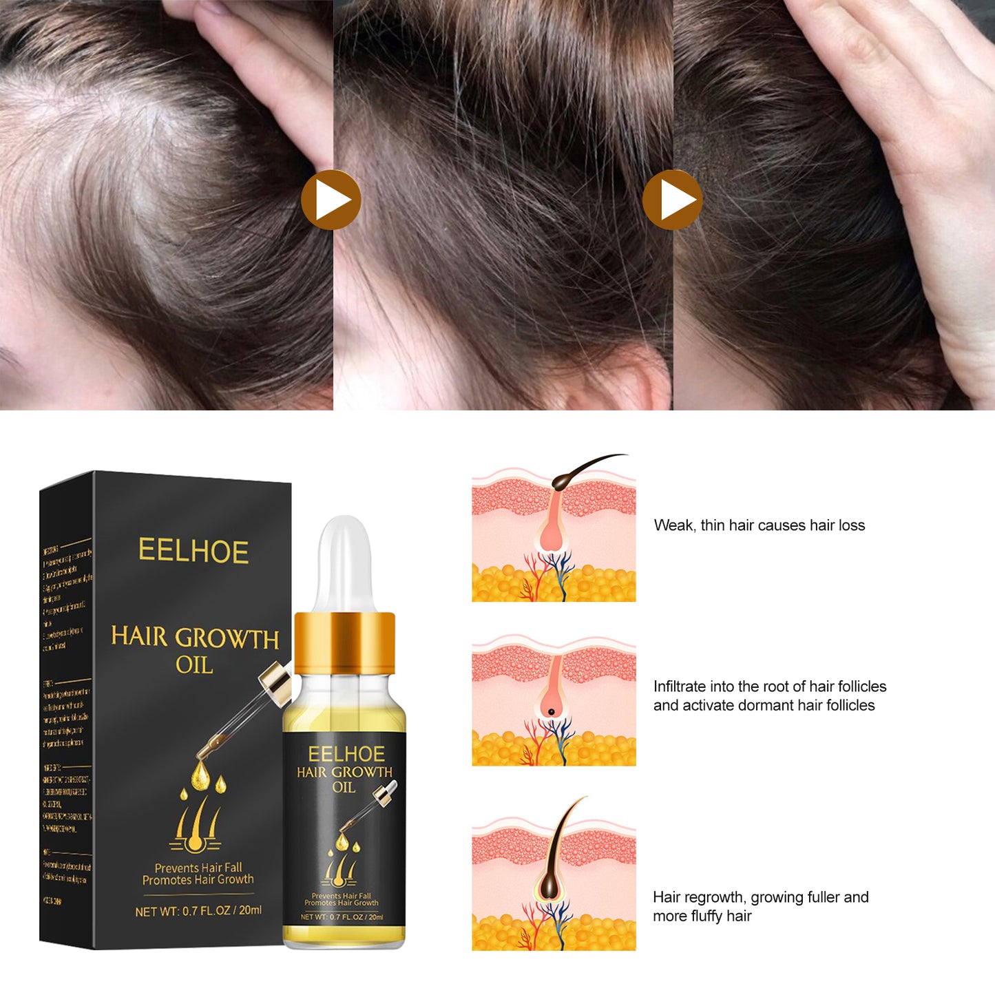 Hair Growth Oil, Strengthens And Strengthens Hair Essential Oil Softens And Moisturizes Hair And Thickens Hair Nutrient Solution